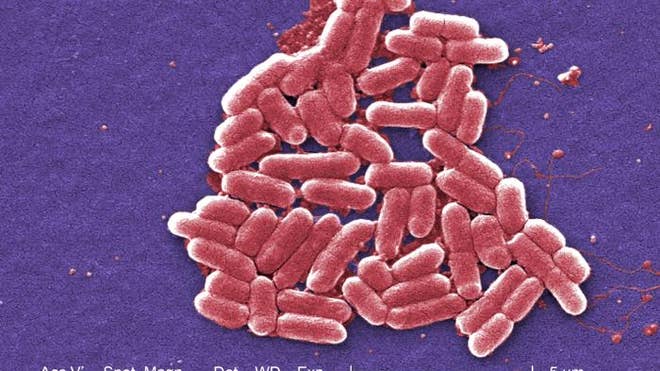 E. coli